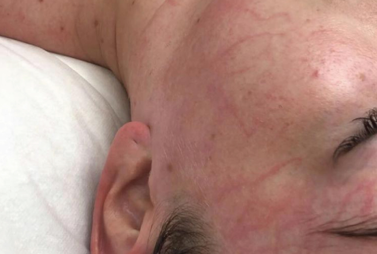 Lymphatic Therapy at Skin and Body Lounge